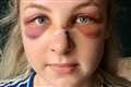 Teenager avoids jail despite officer needing surgery after ‘horrific’ attack