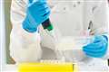Breakthrough cancer treatment prevented leukaemia for 10 years, study shows
