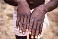 Pride events ‘can spread public health messages about monkeypox’