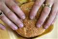 Brain’s appetite control centre different in overweight or obese people – study