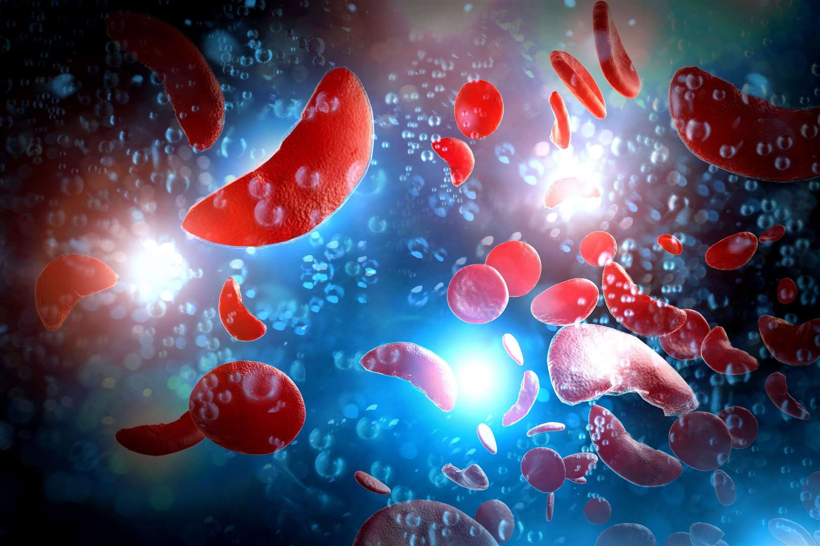 3D illustration of sickle cell disease blood cells (Alamy/PA)
