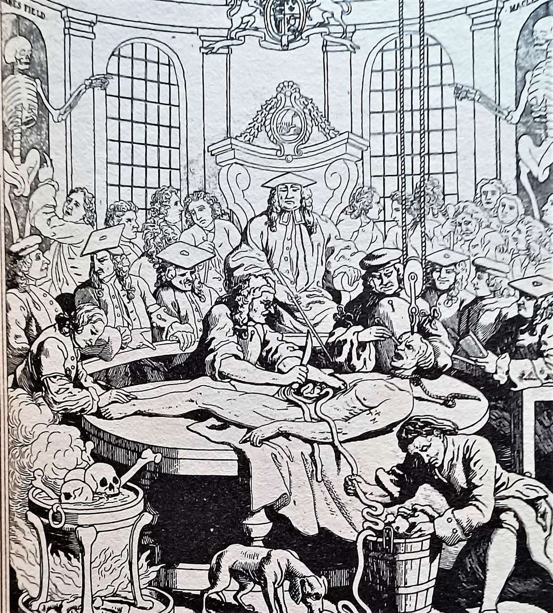 William Hogarth's illustration of an anatomy lesson in the 18th century.