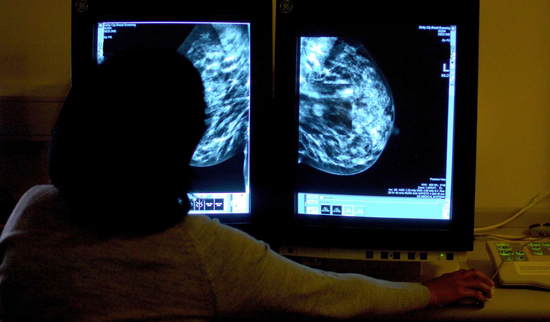 Breast cancer screening was brought in 35 years ago (Rui Vieira/PA)