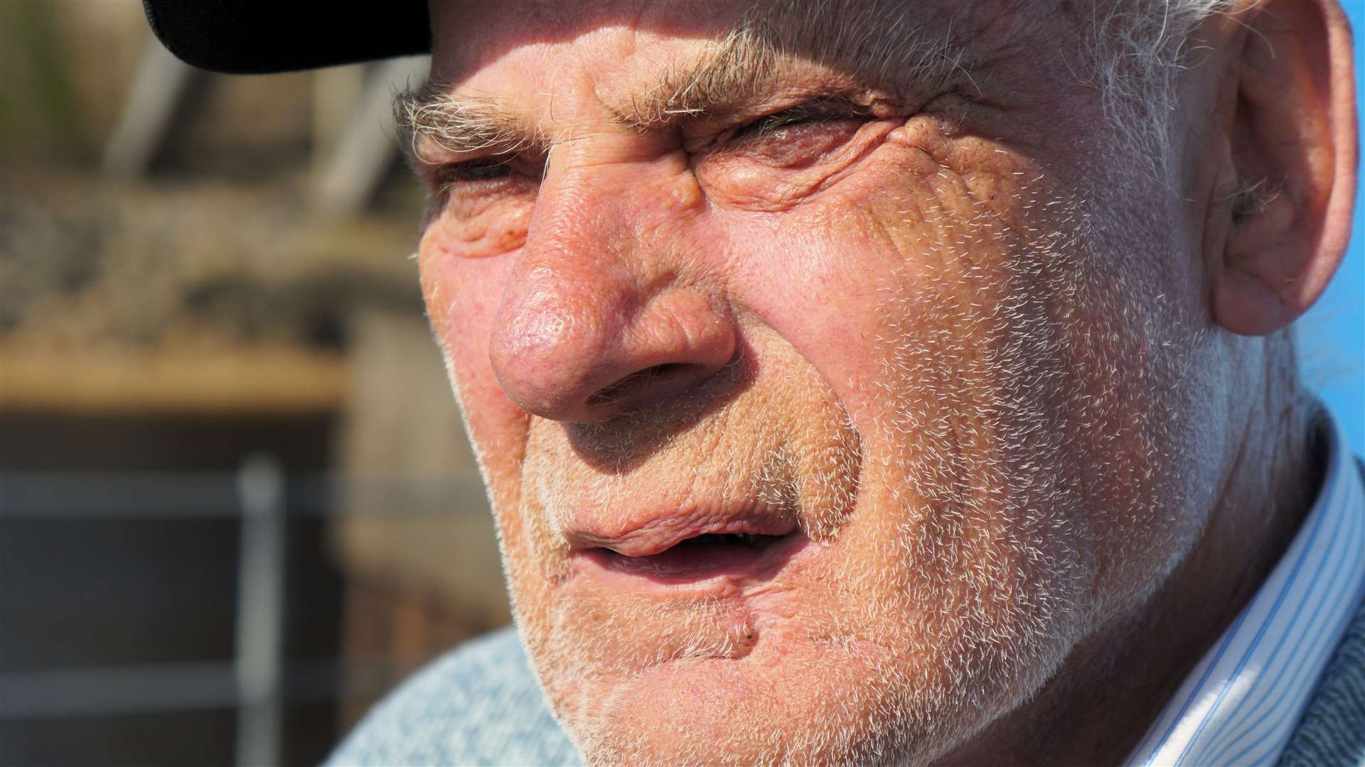 Charlie has numerous health issues and pointed out a scar near his lower lip where he had surgery to remove cancerous cells. Picture: DGS