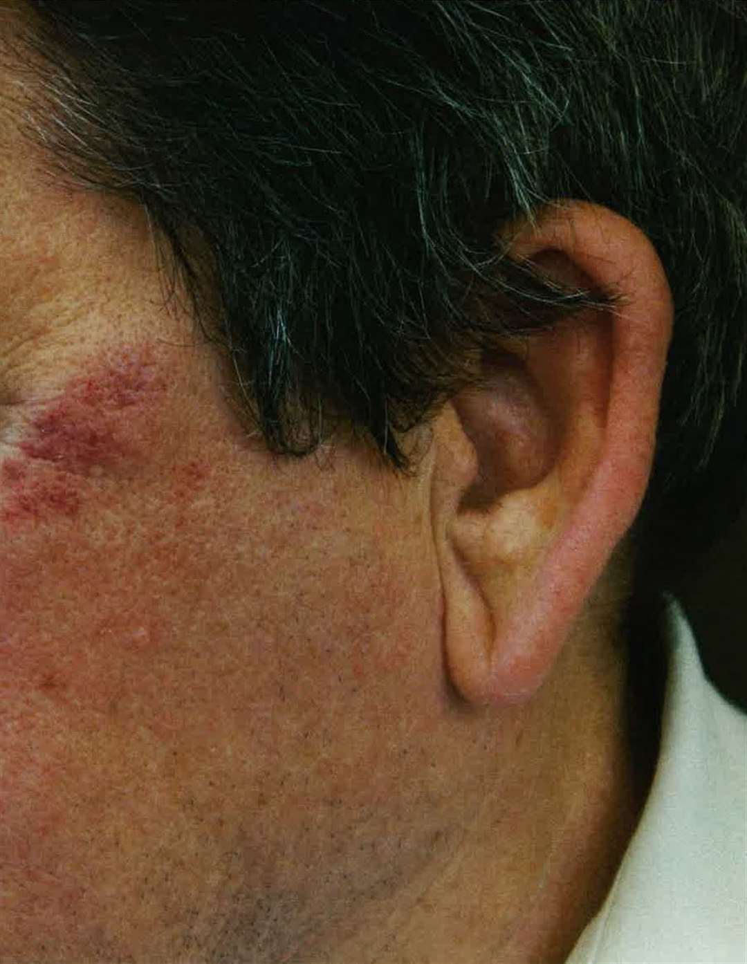 Injuries caused to prison officer Paul Edwards (Met Police/PA)