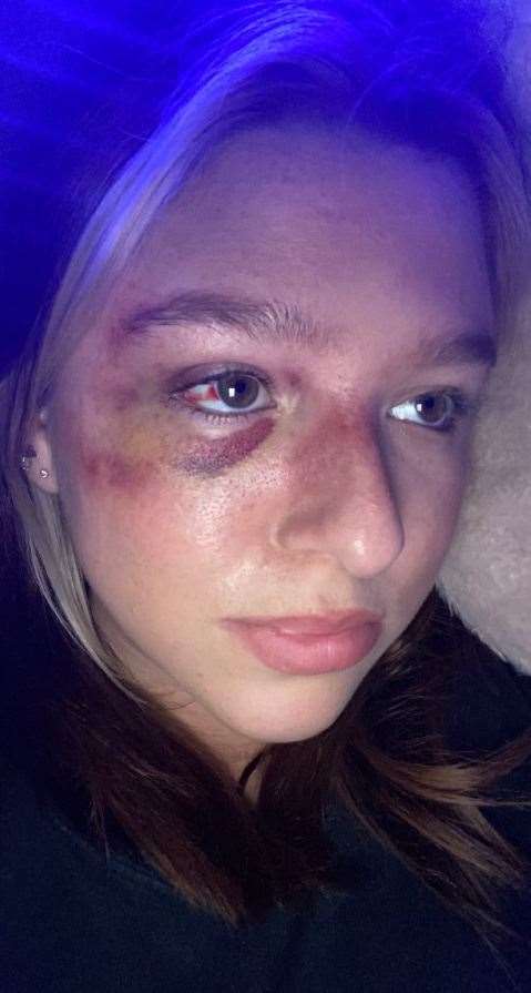 Lauren was seriously injured after a woman attacked her in Inverness city centre leaving her with lasting injuries.